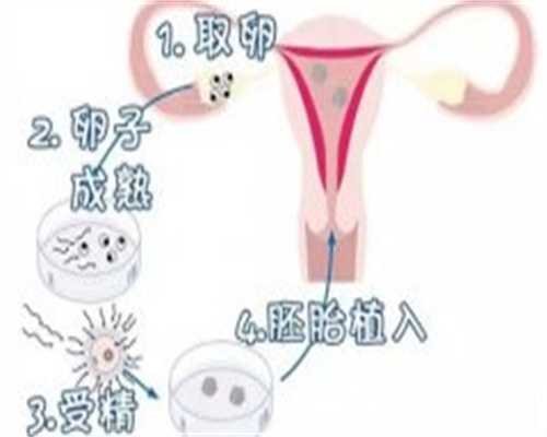 安徽地区三代试管供卵费用及医疗机构解析