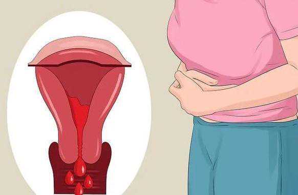 八珍益母丸对宫寒女性调理的考量